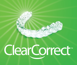 clear orthodontics