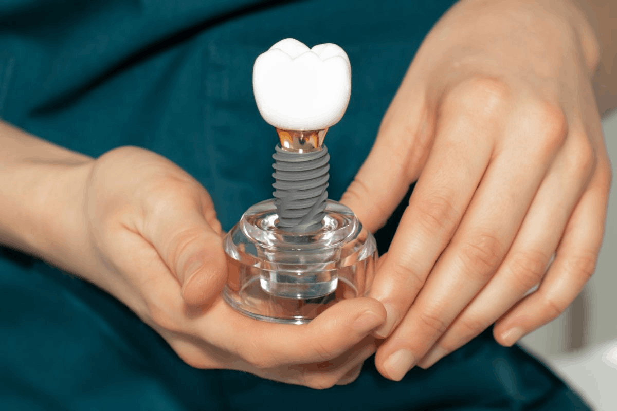What to Expect During the Dental Implant Healing Timeline in Bel Air