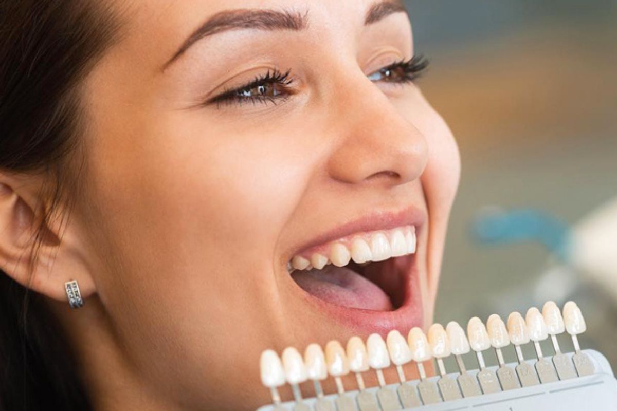 Are Dental Veneers Right for Your Smile? What to Consider Before Treatment